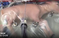 Twitching of fetal sheep in artificial womb